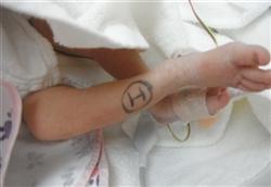 双子,管理入院,張り止め,副作用GCU母子同時退院の条件