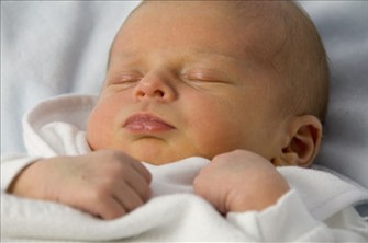 新生児黄疸 とは 基礎知識